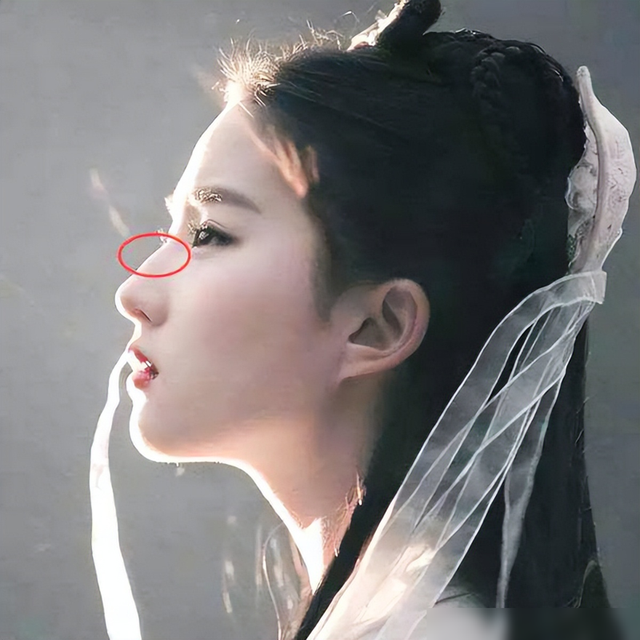 “蒜头鼻”对颜值影响有多大？看完这几组对比图后，你就知道了