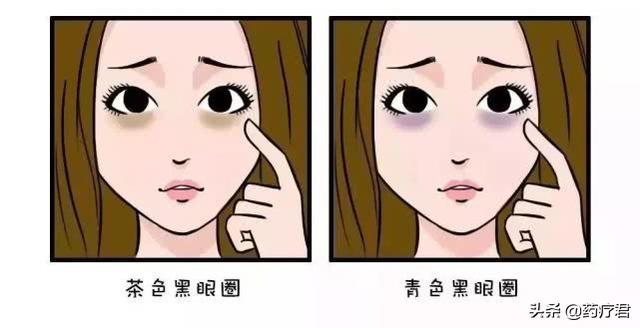 有黑眼圈就是肾虚吗？它究竟是如何产生的，又该如何消除？