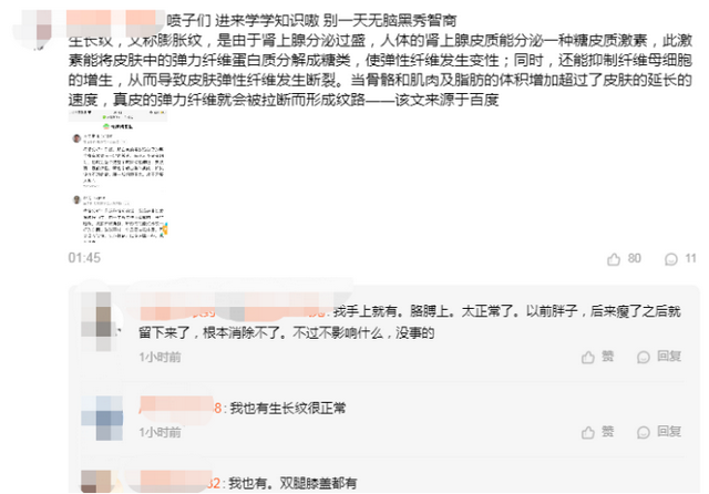 呆妹被质疑清白后气炸，当场卷裤子露腿：哪有妊娠纹？