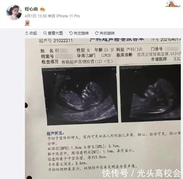 和豪刷700万榜一奔现后,斗鱼女主播晒孕检报告,已经怀孕12周