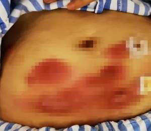 女主播肚子疼(“你太胖了吧”杭州25岁女网红全身感染一掀肚子令人崩溃)