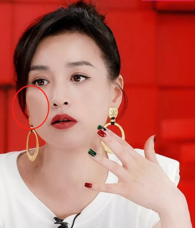 明星直播滤镜太强!张庭酒窝消失,曹颖痣都快没了,生图曝光尴尬