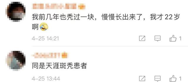 知名女主持自爆患斑秃，头顶空出一块头皮……网友纷纷晒同款